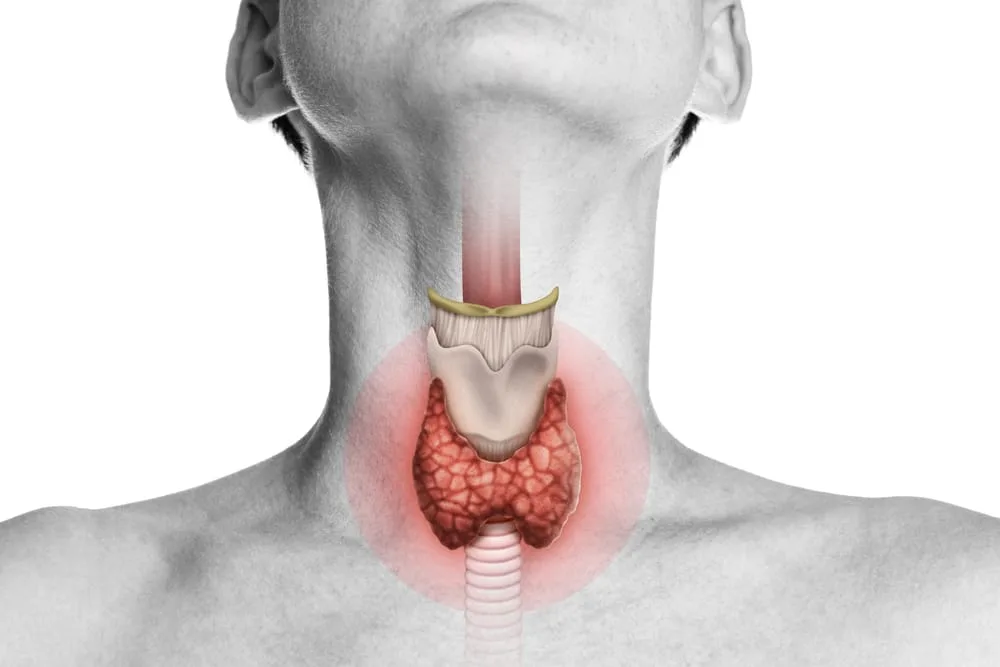 Tireoide